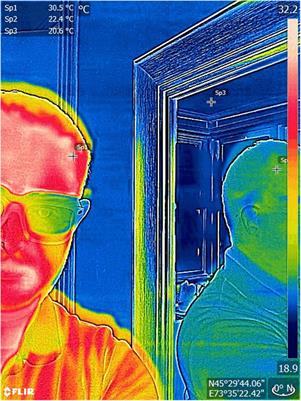 Infrared Thermography in Wound Care, Surgery, and Sports Medicine: A Review